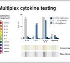 Rapid PSA Measurement and Multiplex Cytokine Testing